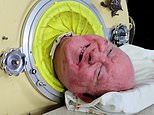 Iron lung man Paul Alexander dead at 78: Lawyer who was paralysed after suffering Polio as a six year old and lived in an iron lung for 70 years dies