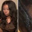 Mum shares horror picture of little girl's scalp after teaching assistant 'ripped her braid out'