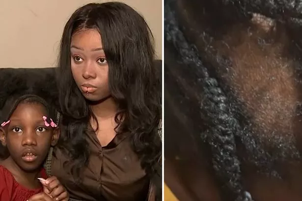 Mum shares horror picture of little girl's scalp after teaching assistant 'ripped her braid out'