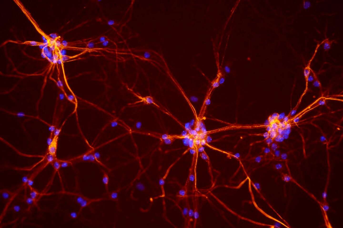 La moelle épinière, ce tissu nerveux capable d’apprendre et de mémoriser