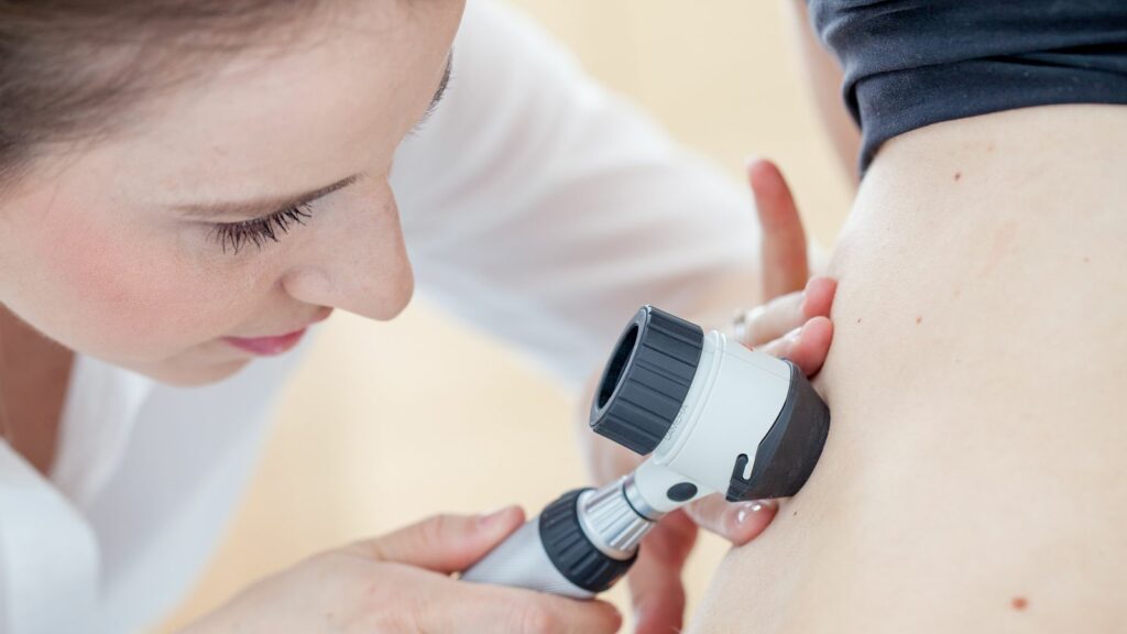 Dermatologist Inspecting Patient Skin Moles stock photo. Key words, melanoma, skin cancer. Pic: CasarsaGuru/iStock