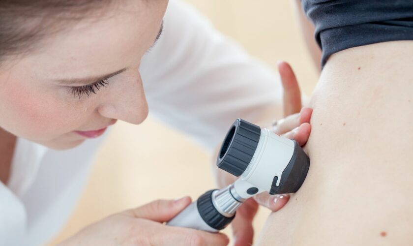 Dermatologist Inspecting Patient Skin Moles stock photo. Key words, melanoma, skin cancer. Pic: CasarsaGuru/iStock