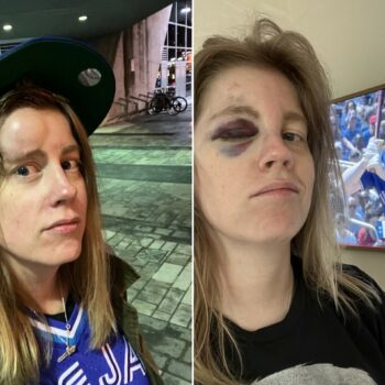 A fan hit by a foul ball stayed through the 9th. Now she’s on a baseball card.