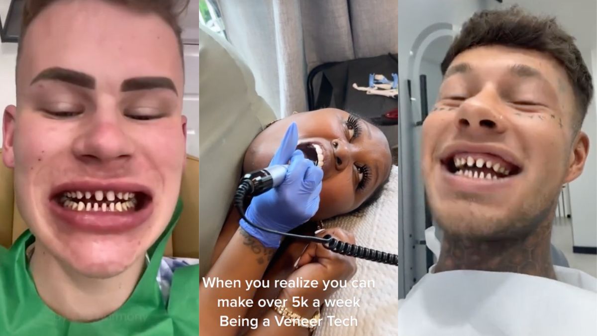 Sur TikTok, de faux dentistes liment les dents de leurs patients