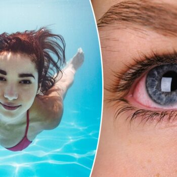 Ask a doctor: ‘Is it safe to swim underwater with my eyes open?’