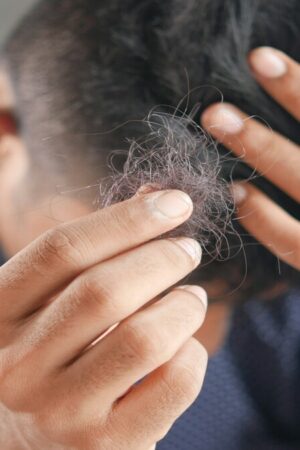 Des scientifiques ont peut-être trouvé le remède miracle contre la perte de cheveux