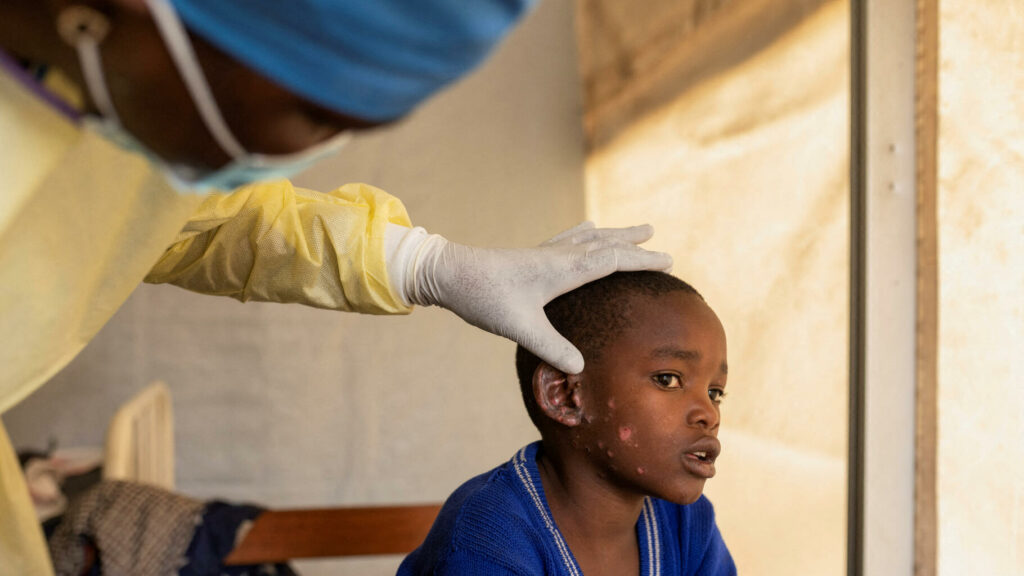 Épidémie de « mpox » 2024 en Afrique : pourquoi les scientifiques la jugent plus préoccupante que celle de 2022