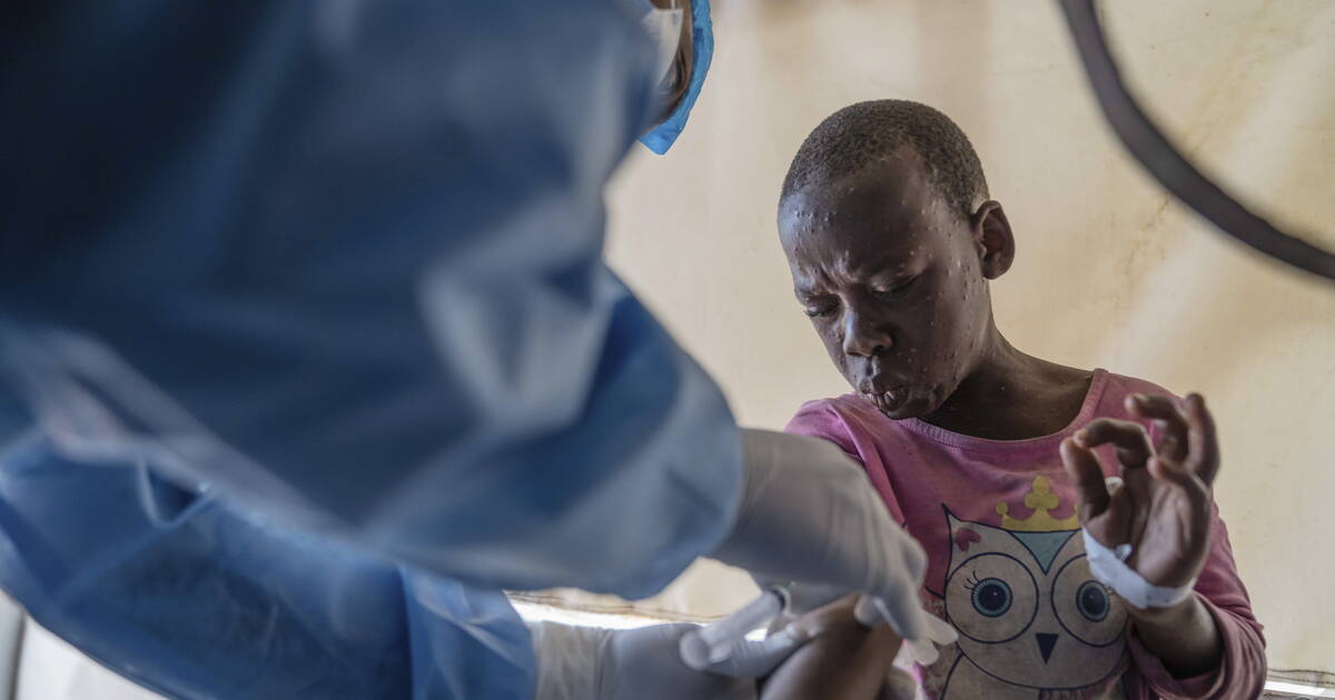 Mpox : l’Institut Pasteur prêt à «tester et vacciner» face à la recrudescence de l’épidémie