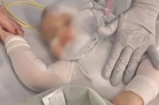 Baby boy suffers severe burns after stranger pours scalding coffee over him