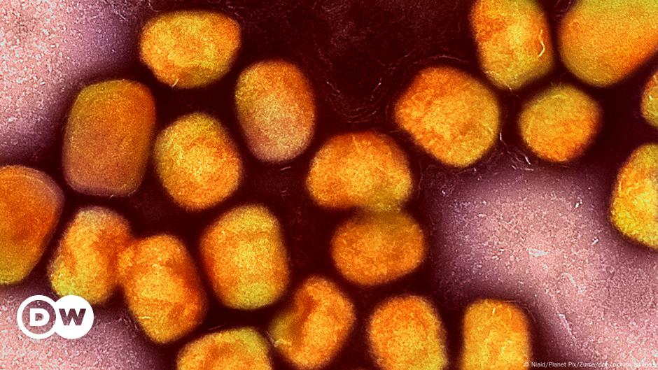 Faktencheck: Keine Verbindung zwischen Mpox und COVID-Impfung