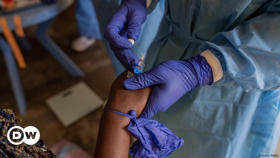 Mpox: Germany to give Africa 100,000 doses of vaccine