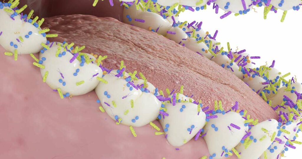L’efficace stratégie de division bactérienne qui permet à la plaque dentaire de prospérer