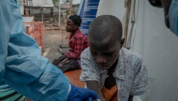 Un patient dans un centre de santé dédié au virus mpox à l'hôpital Nyiragongo, à Goma, en RDC, le 16 août 2024