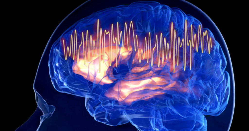 Une anomalie de l’activité cérébrale pourrait être un signe précurseur de la maladie d’Alzheimer