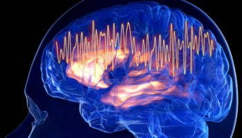 Une anomalie de l’activité cérébrale pourrait être un signe précurseur de la maladie d’Alzheimer