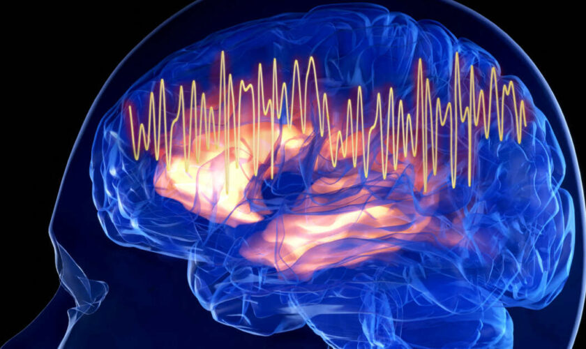 Une anomalie de l’activité cérébrale pourrait être un signe précurseur de la maladie d’Alzheimer