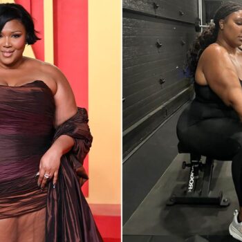 Lizzo slams 'Ozempic allegations' after weight loss transformation