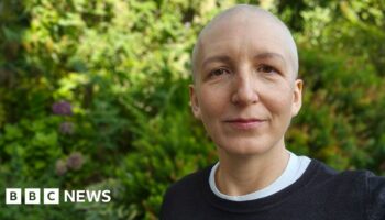 Hair loss, nosebleeds, and a Taylor Swift concert: How I coped with chemo