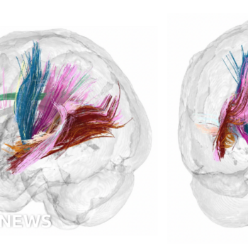 Pregnancy brain changes revealed in detailed scans