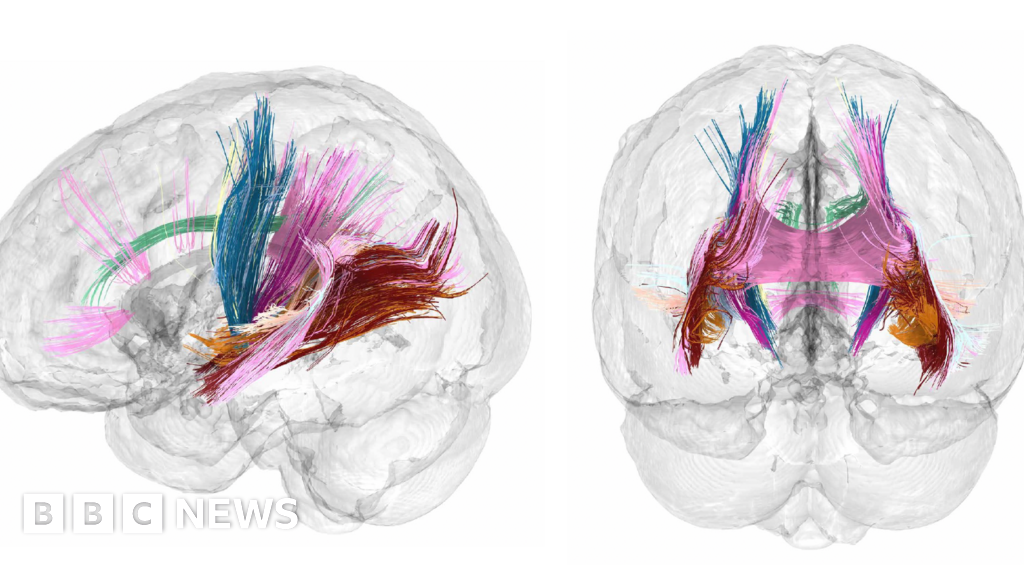 Pregnancy brain changes revealed in detailed scans