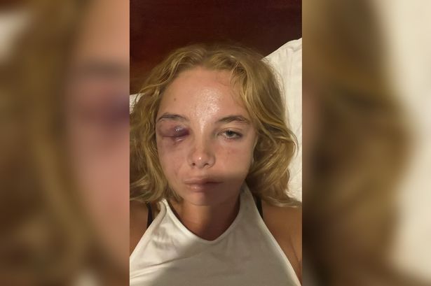 Teacher has 'phobia of going outside' after being attacked in her hotel room on holiday