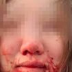 Woman left battered in Birmingham bus stop attack by sick racist girls hurling horror abuse