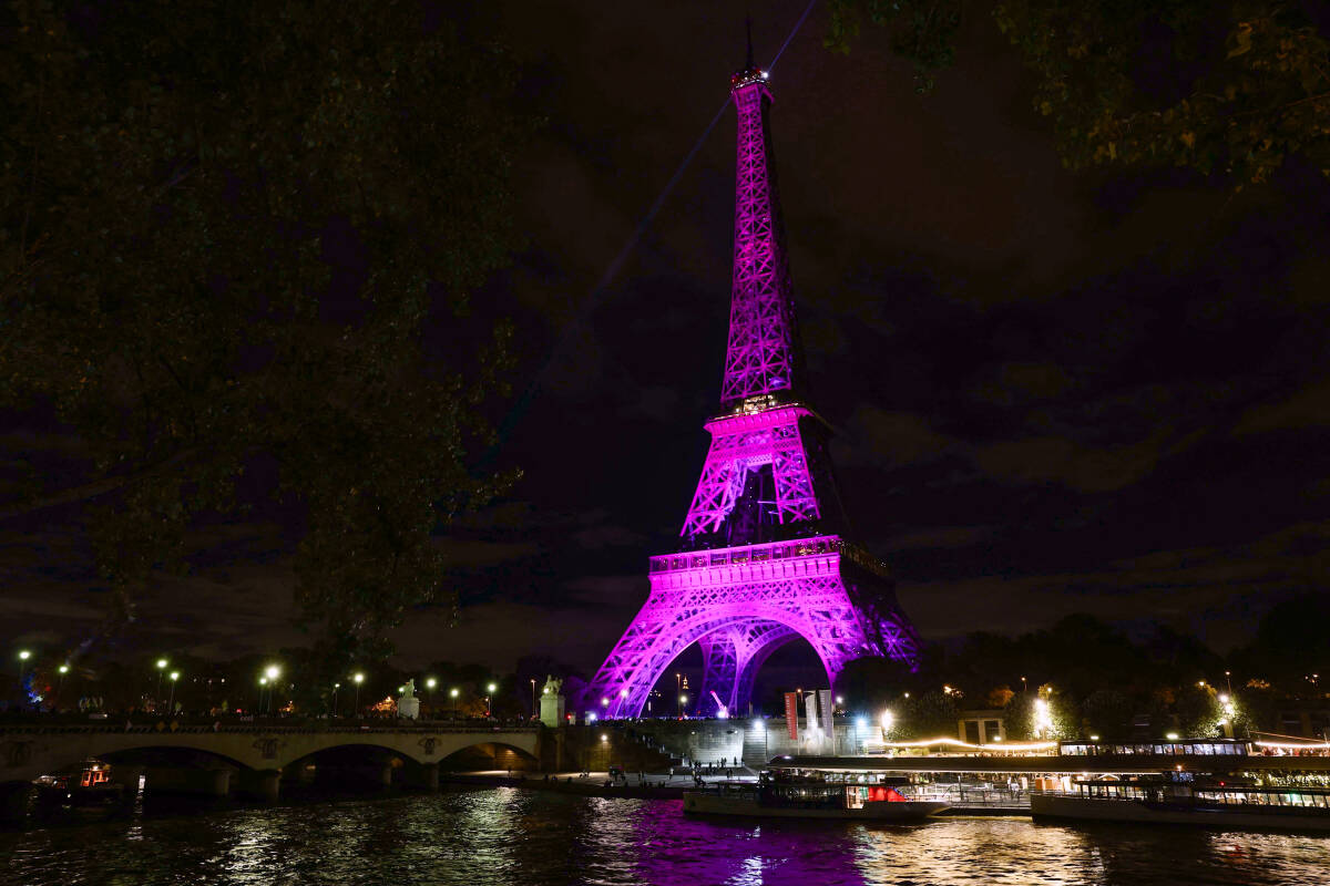 « La France est le pays européen qui compte le plus de cancers du sein. Nous devons comprendre pourquoi »