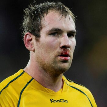 FILE PHOTO: Australia Wallabies' Rocky Elsom bleeds during the first half of their Rugby World Cup Pool C match against the U.S. at Wellington Regional Stadium in Wellington September 23, 2011. REUTERS/Anthony Phelps/File Photo