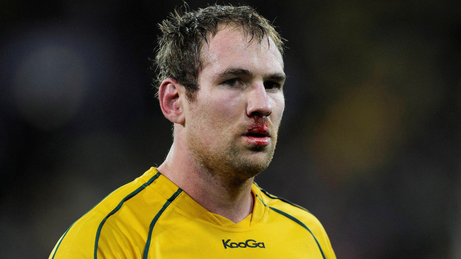 FILE PHOTO: Australia Wallabies' Rocky Elsom bleeds during the first half of their Rugby World Cup Pool C match against the U.S. at Wellington Regional Stadium in Wellington September 23, 2011. REUTERS/Anthony Phelps/File Photo