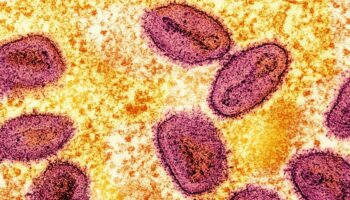 RKI meldet ersten Nachweis von neuer Mpox-Variante in Deutschland