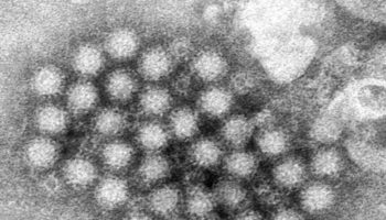 What would the norovirus vaccines mean for NHS pressure and wait times?