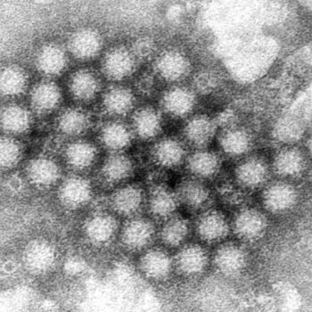 What would the norovirus vaccines mean for NHS pressure and wait times?