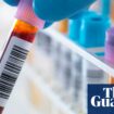 Concerns raised over access to UK Biobank data after ‘race scientists’ claims