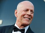 Doctor: Joe Biden shows same signs of dementia as Bruce Willis before his diagnosis