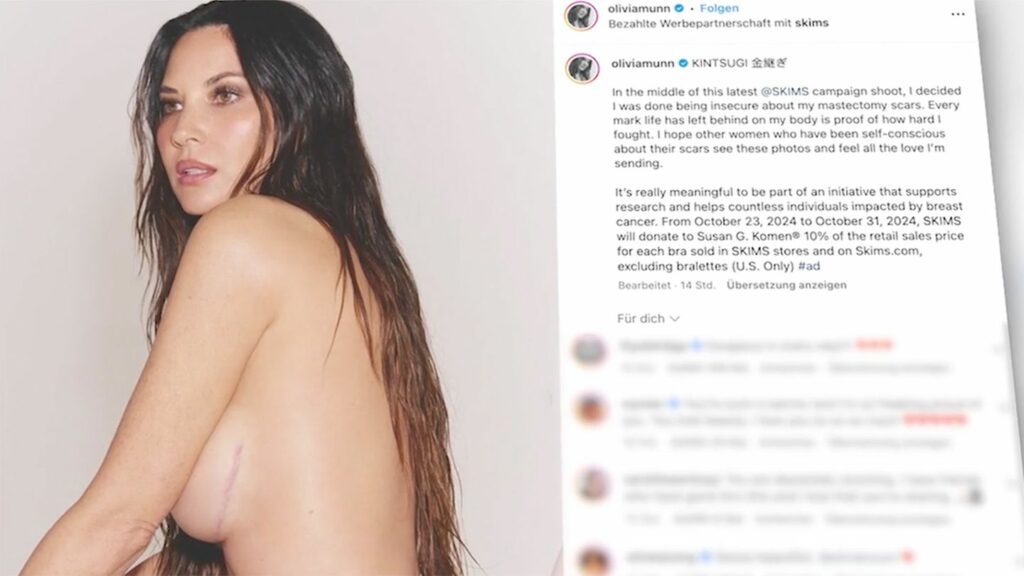 Fotoshooting für Kardashian: Hollywood-Star Olivia Munn zeigt Narben nach Brustkrebs-OP