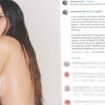 Fotoshooting für Kardashian: Hollywood-Star Olivia Munn zeigt Narben nach Brustkrebs-OP