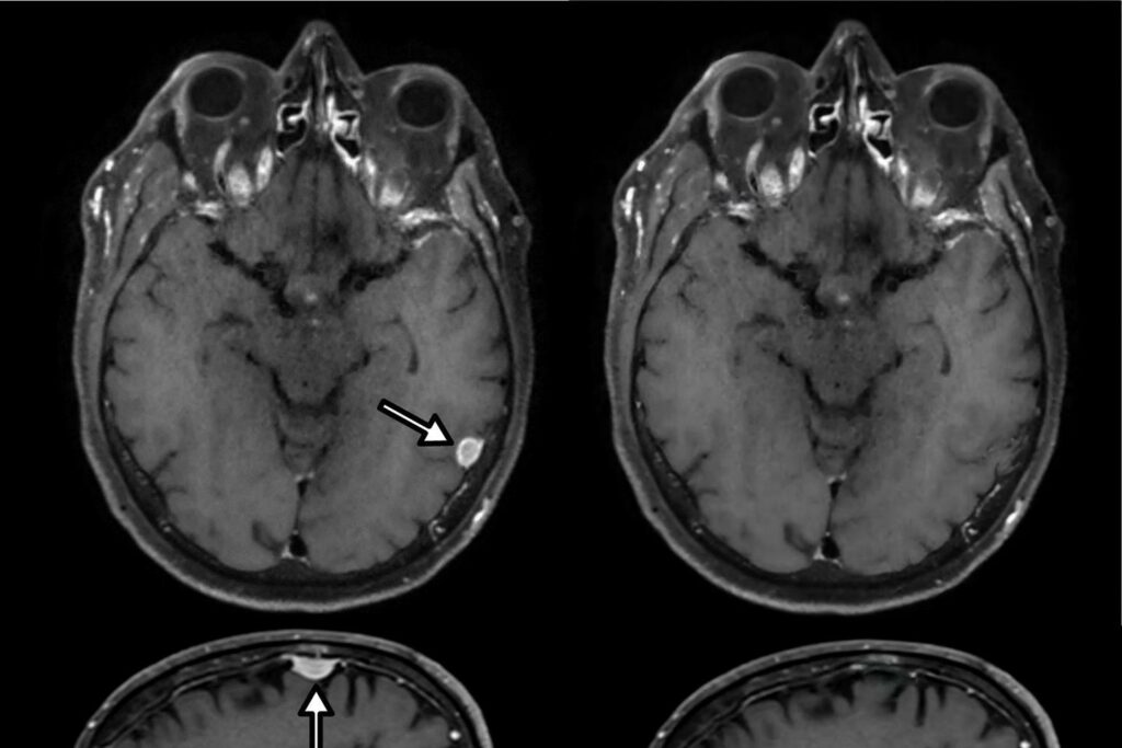 La falsification d’images médicales numériques est possible avec un simple smartphone