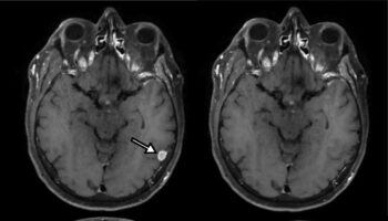 La falsification d’images médicales numériques est possible avec un simple smartphone