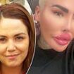 Lip King Jordan James Parke breaks his silence over BBL death of Alice Webb