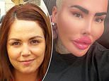 Lip King Jordan James Parke breaks his silence over BBL death of Alice Webb