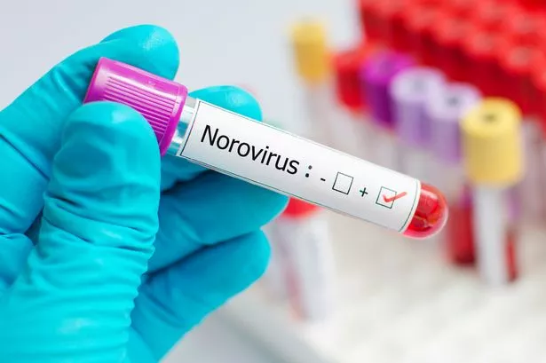 Norovirus vaccine: Everything we know about jab that could end winter vomiting bug for good