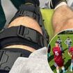 Welsh football team ATTACKED with 'baseball bats and bike seats' after ill-tempered Sunday League clash - with one player suffering 'life-changing injuries' during the violent assault