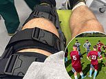 Welsh football team ATTACKED with 'baseball bats and bike seats' after ill-tempered Sunday League clash - with one player suffering 'life-changing injuries' during the violent assault