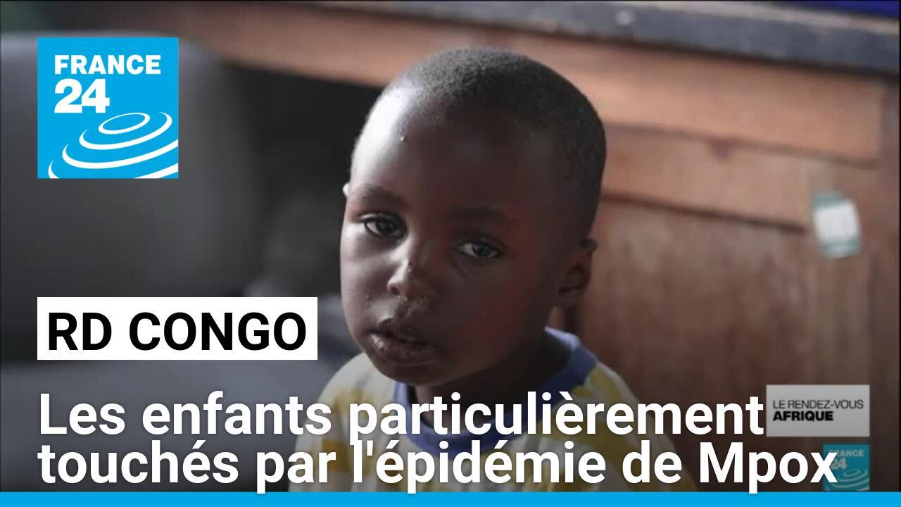 RD Congo : les enfants particulièrement touchés par l'épidémie de Mpox