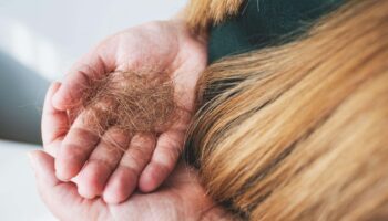 Why winter hair loss happens and how can you stop it