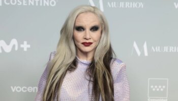 Alaska se sincera sobre su relación con las operaciones estéticas: «Si tuviera un cirujano menos prudente...»