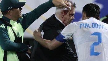 Football : le sélectionneur mexicain Javier Aguirre en sang après un jet de canette au Honduras