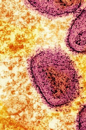 Mpox : l’Organisation mondiale de la santé maintient son plus haut niveau d’alerte