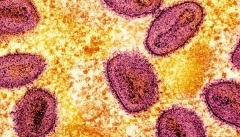 Mpox : l’Organisation mondiale de la santé maintient son plus haut niveau d’alerte