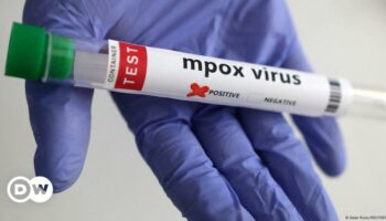 US reports first case of new mpox variant